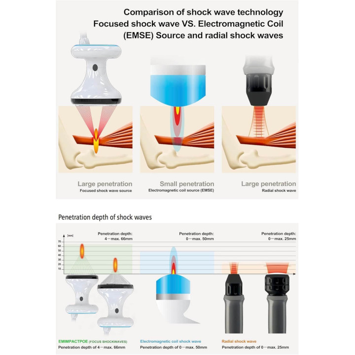 focused shockwave therapy machine